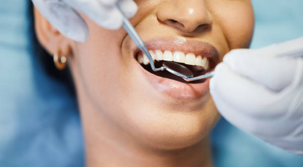 Best Emergency Dental Care for Broken or Chipped Teeth in Justice, OK